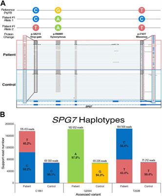 Integration of multi-omics technologies for molecular diagnosis in ataxia patients